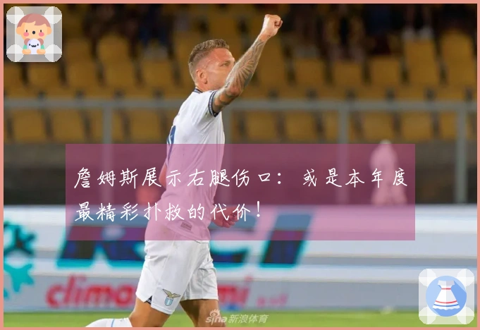 詹姆斯展示右腿伤口：或是本年度最精彩扑救的代价！